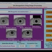 Iris Recognition Using Matlab Project Iris Recognition Using Machine Learning Matlab Code
