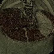 Abdomen Stomach 3D Volume Rendering With Variation In The Lighting Model