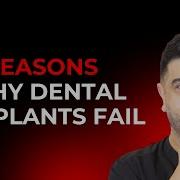 3 Reasons Dental Implants FAIL And How To Prevent It