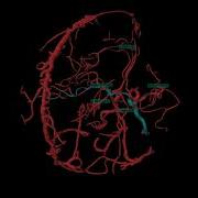 PART 1 VirtualDSA Segmentation Modelling And Interaction With The Cerebrovascular Vessel Tree