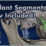 BSPV5 0 Implant Segmentation Now Included Completely Automatic CT Segmentation FREE