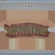 Digital Ortho Models Design Virtual Bases