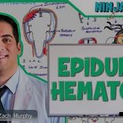 Epidural Hematoma Anatomy Etiology Pathophysiology Clinical Features Treatment