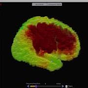 Neuroguide Current Density