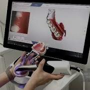 Digitaler 3D Scan CEREC Primescan