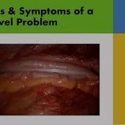 Bowel Resection Part 1 Signs Of A Bowel Problem