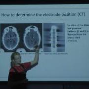 Electrode Reconstructions VTA Modeling