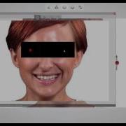 3Shape DentalSystem Fast 3D Digital Smile Design