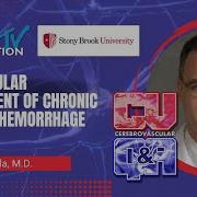 Endovascular Management Of Chronic Subdural Hemorrhage David Fiorella MD