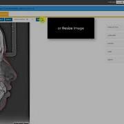 CephX Editing Cephalometric Tracing