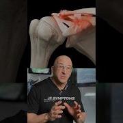 Shoulder Separation AC Joint Dislocation Shorts