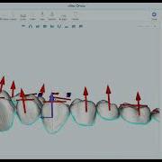 AI Teeth Segmentation