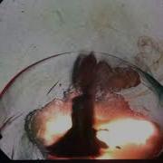 Shockwave From Explosion