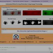 Blood Group Detection Using Image Processing MATLAB Project Source Code