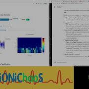 EEG Spectrogram A Python Flask EEG Analysis Tool Development Part 3