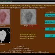 Skin Disease Detection Using CNN Convolutional Neural Network Python OpenCV Project Source Code