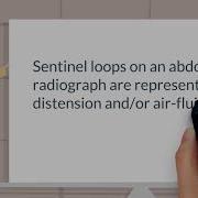 What Are Sentinel Loops
