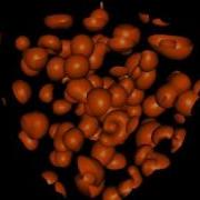 Gray Scott Reaction Diffusion Equation In 3D