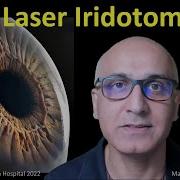 Laser Iridotomy The Works Mahesh Ramchandani Explores All About Laser For Angle Closure Glaucoma