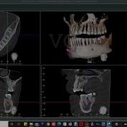 CBCT SOFTWARE DEMONSTRATION