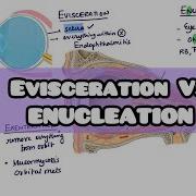 Evisceration VS Enucleation Eye Removal Surgery For Inicet Usmle Neetpg Fmge Firstaidusmle