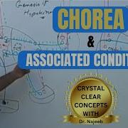 Chorea And It S Associated Conditions Neurophysiology