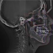 WillCeph Automated Cephalometric Analysis Software