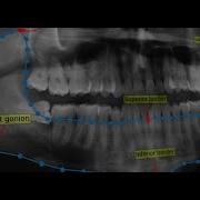 Applying Deep Learning To Biomedical Image Analysis