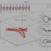 Reconstructed Attractor Of NORMAL WALKING Activity Using Accelerometer Based Sensor Data