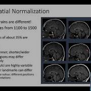 Methods L3 1 Normalization