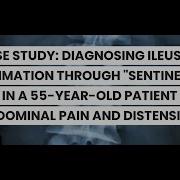 CASE STUDY DIAGNOSING ILEUS OR INFLAMMATION THROUGH SENTINEL LOOP SIGN