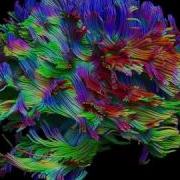 Whole Brain Fiber Tractography