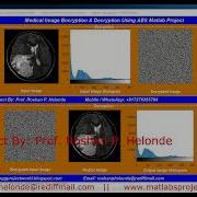 Medical Image Encryption Using AES AES Image Encryption Decryption Using Matlab Code