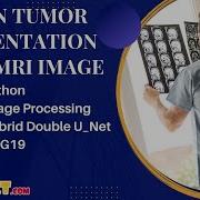 Python Image Processing Projects Brain Tumor Segmentation From Mri Image ClickMyProject