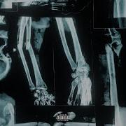 Bones