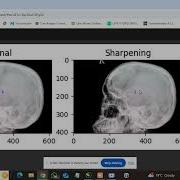 Medical Applications Of Image Processing Using Python Colab