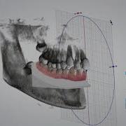 3shape Orthodontic Planner