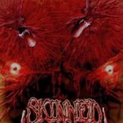 SKINNED Driven By Hate Spawn Of Insanity 2005
