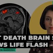 First Scan Of A Dying Human Brain Shows Life Flashes Before Eyes