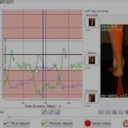 Gait Analysis With PodiaXP Dynamic Interface How To