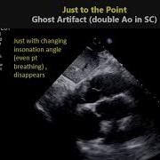 Ghost Artifact Double Ao In SC
