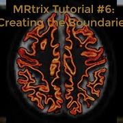 MRtrix Tutorial 6 Creating The Tissue Boundary