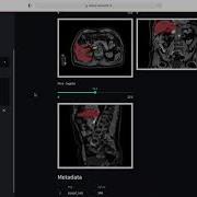 AI Automatic Organ Segmentation And 3D Visualisation Web App