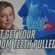 WARNING The Hidden Dangers Of Getting Wisdom Teeth Pulled