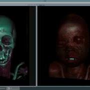 Interactive Volume Ray Casting On GPU