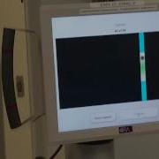 Optiwave Refractive Analysis ORA System