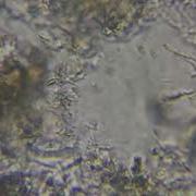 Dental Plaque Biofilm Microscope Images What Lives In Dental Plaque