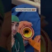 Do You Have Healthy Arteries Arteries Bloodvessels Medicalvideo Doctorexplains