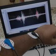 Standard EMG Data Acquisition Multiple Channel