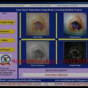 Foot Ulcer Detection Using Image Processing Foot Ulcer Detection Using Deep Learning Matlab Code